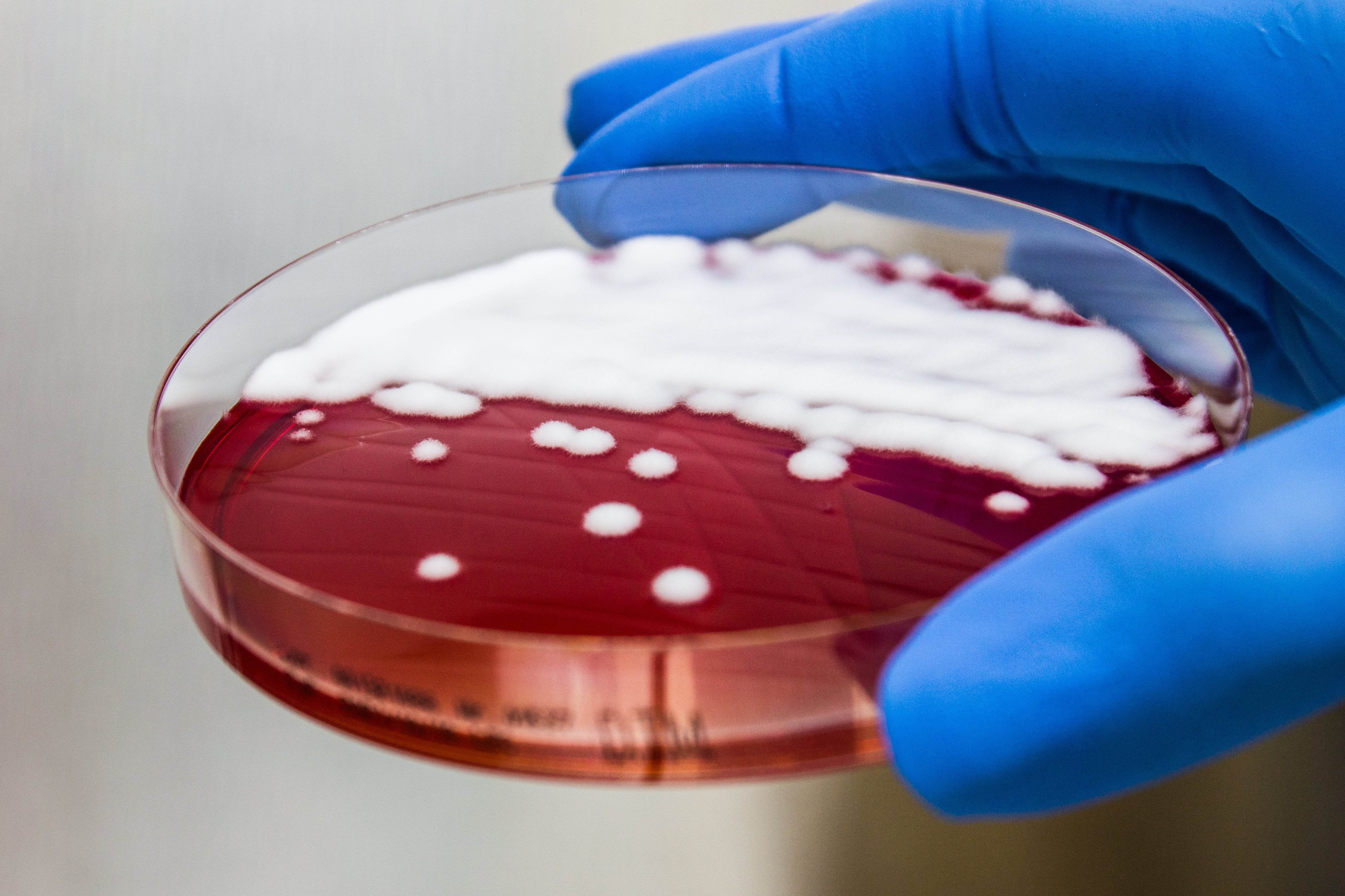 DERMATOPHYTE (D.T.M.) Agar - Kormay Biomedicals store