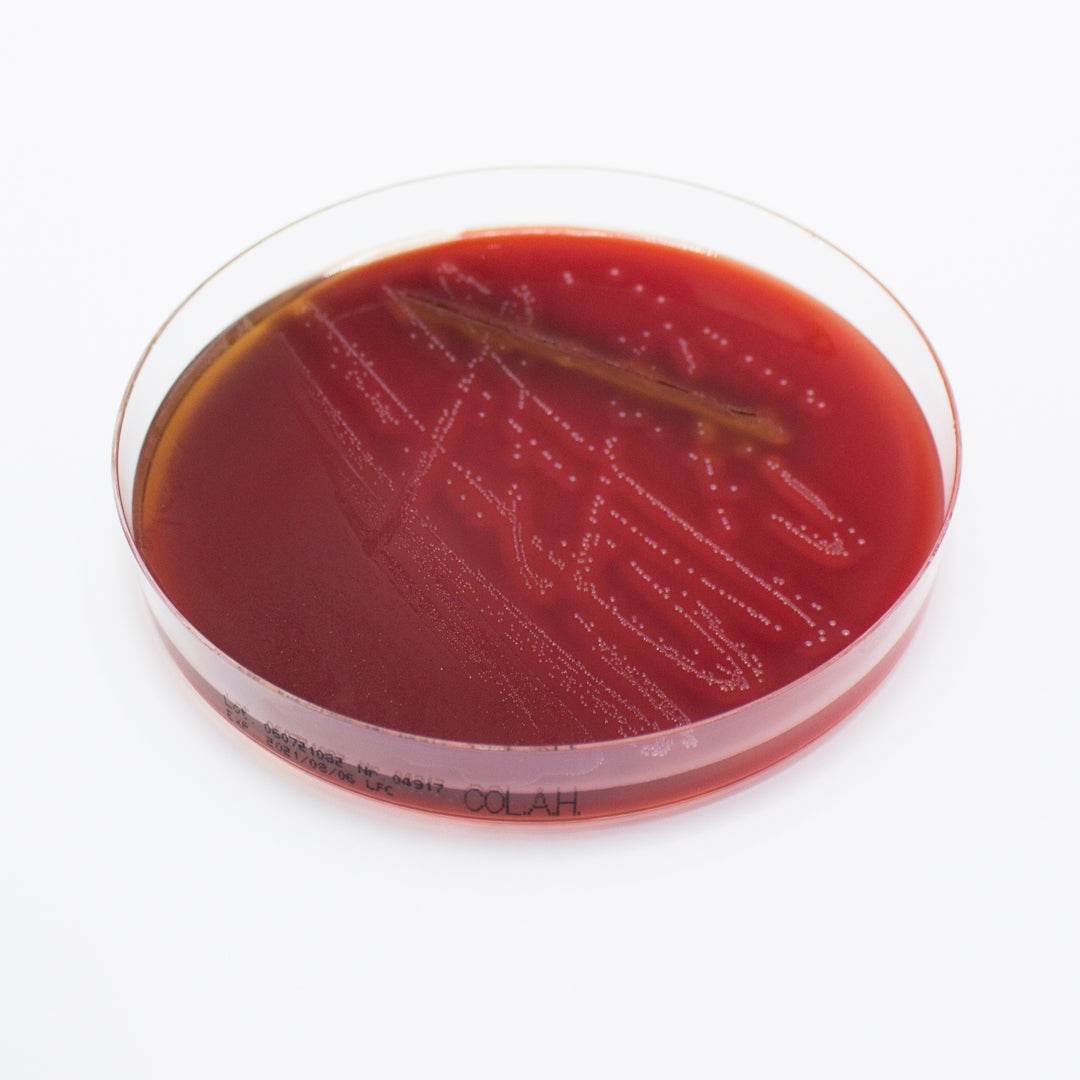 Columbia Agar (Horse Blood 5%) - Kormay Biomedicals store