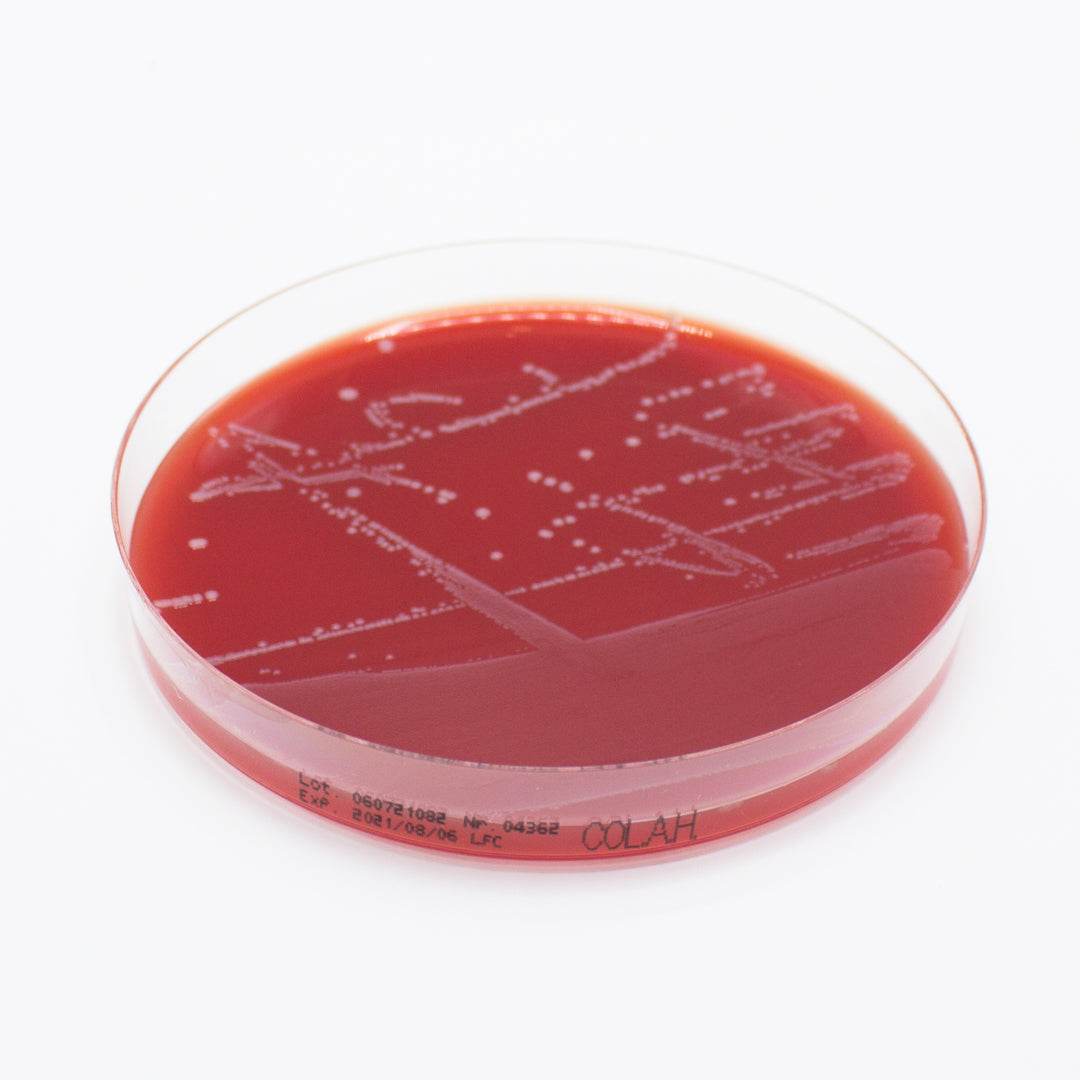 Columbia Agar (Horse Blood 5%) - Kormay Biomedicals store