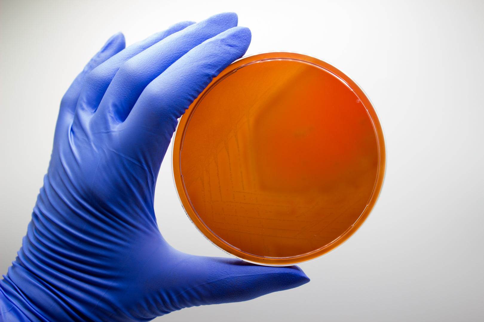 M.S.R.V. Agar - Kormay Biomedicals store