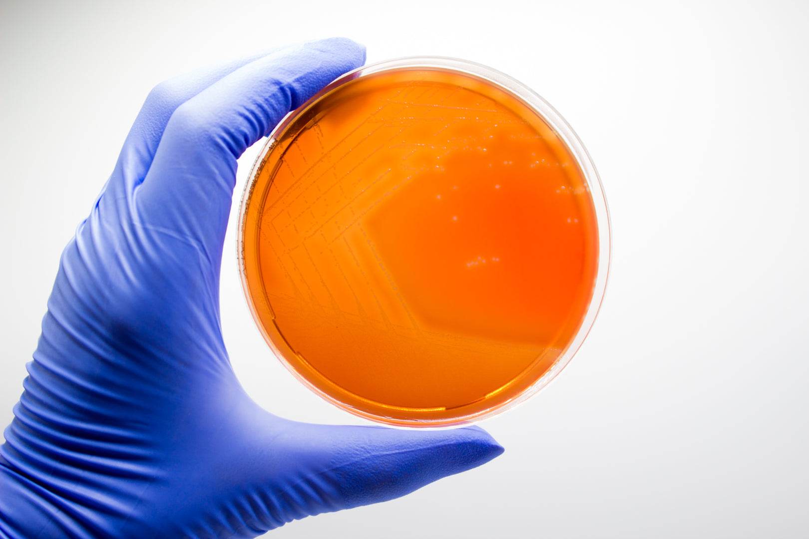M.S.R.V. Agar - Kormay Biomedicals store