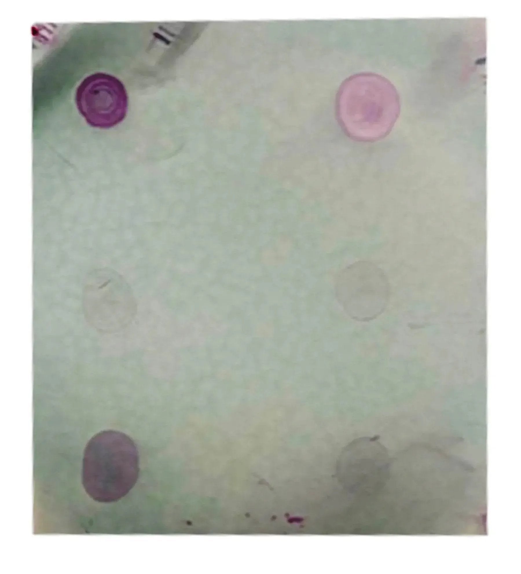 EDVOTEK Biotech Education UNIT Affinity Chromatography of Glucose Binding Proteins