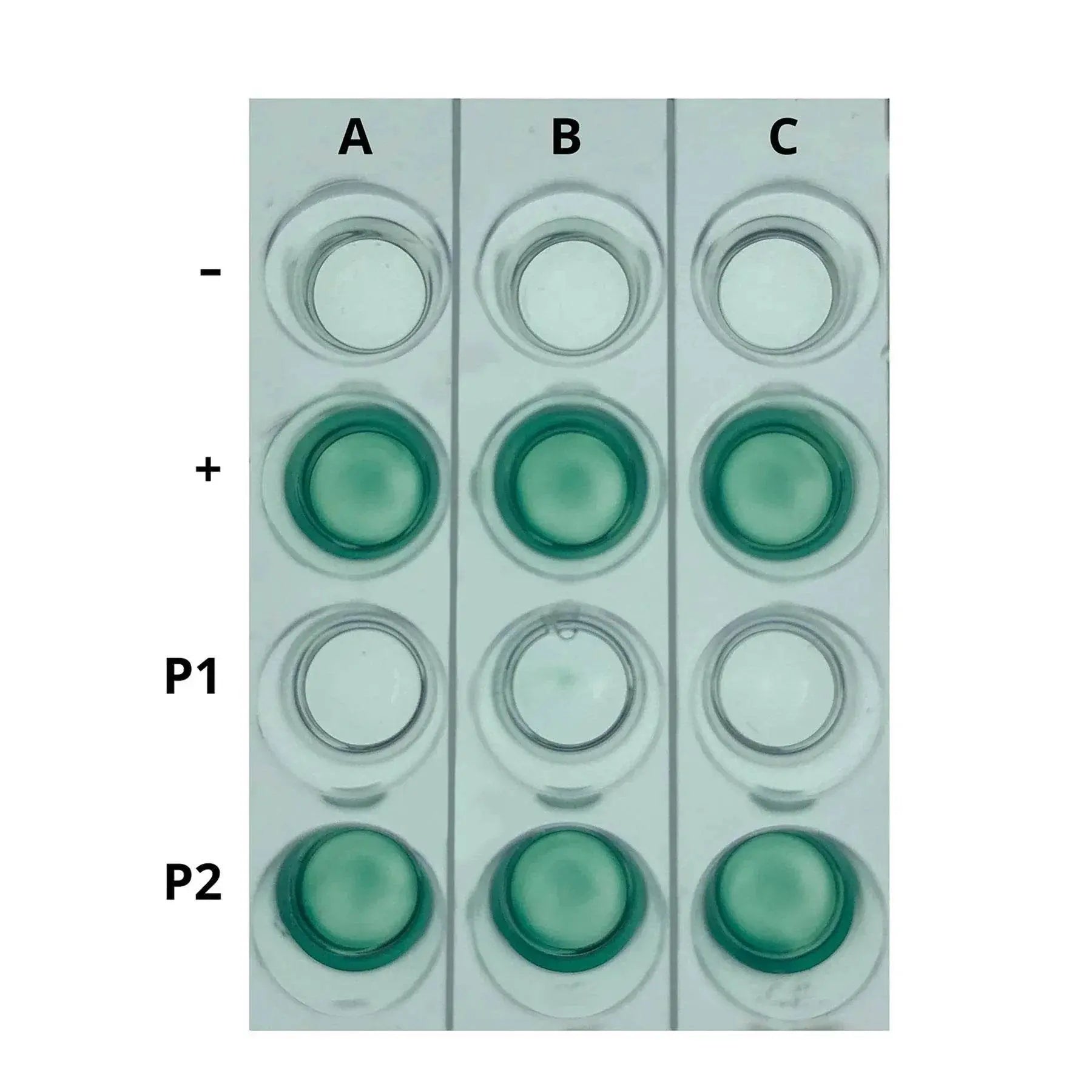 EDVOTEK Biotech Education UNIT AIDS Kit I: Simulation of HIV Detection by ELISA