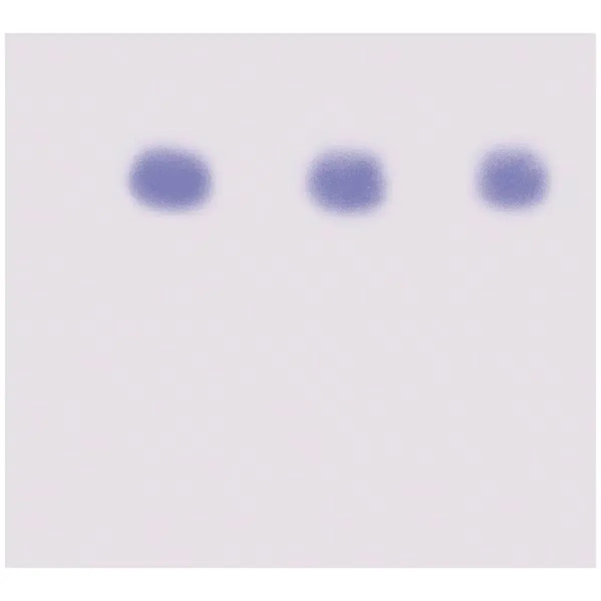 EDVOTEK Biotech Education UNIT AIDS Kit II: Simulation of HIV Detection by Western Blot