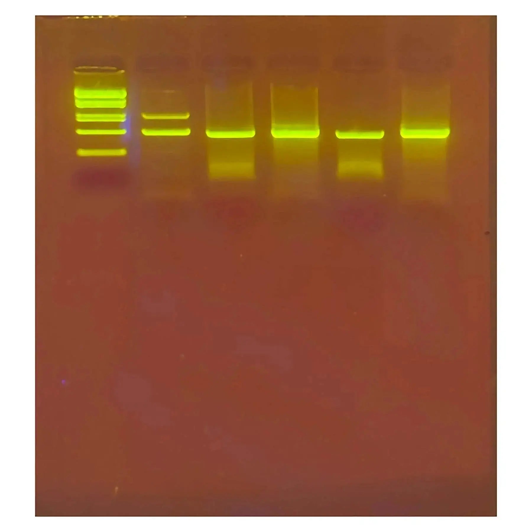 EDVOTEK Biotech Education UNIT Alu-Human DNA Typing Using PCR