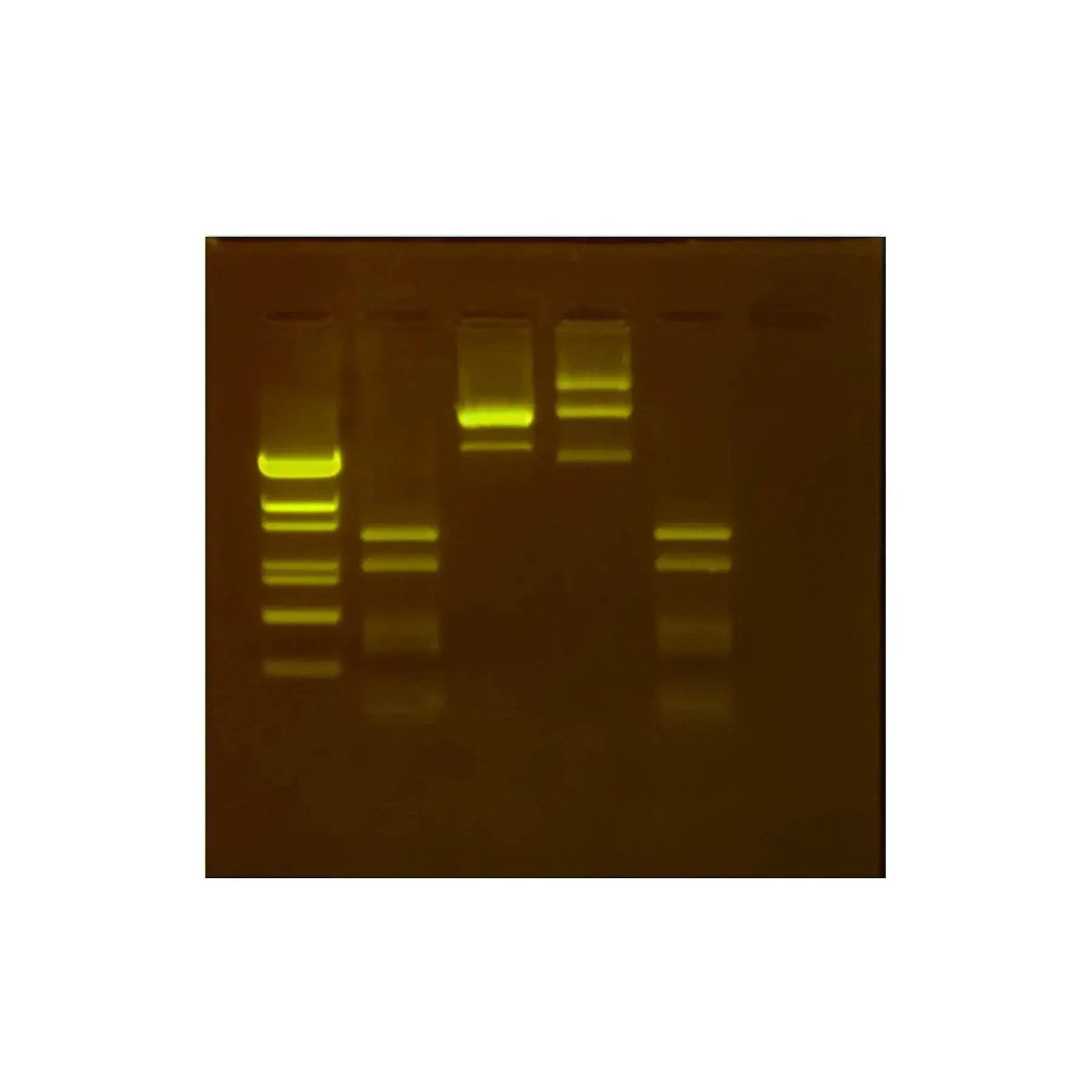 EDVOTEK Biotech Education UNIT Anaylsis of DNA Methylation Using Restriction Enzymes