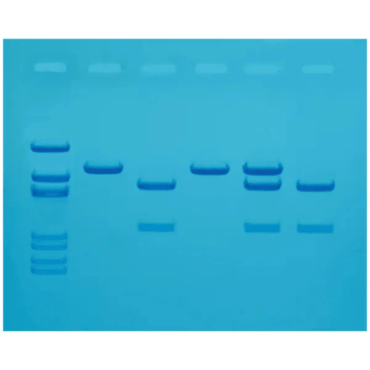 EDVOTEK Biotech Education UNIT Cholesterol Diagnostics