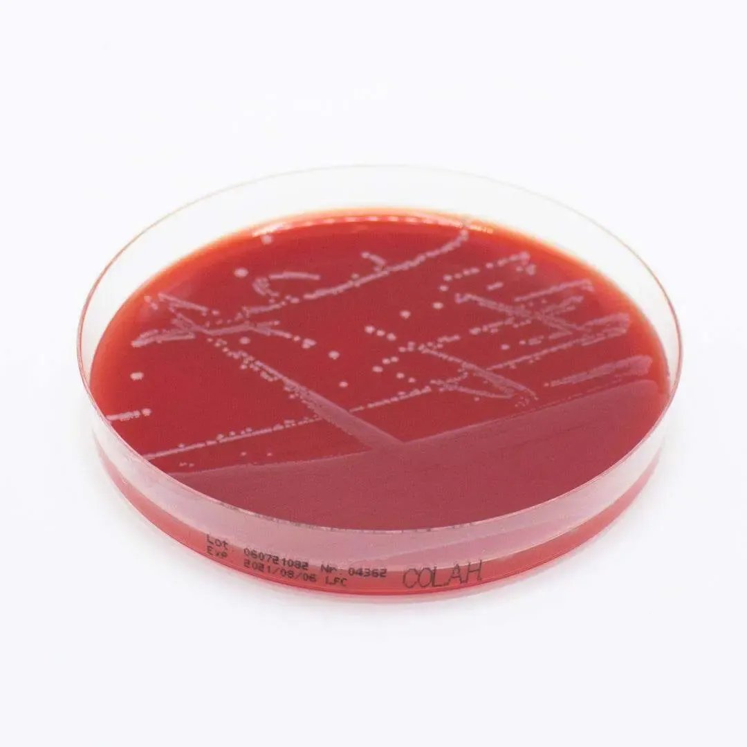 Liofilchem Columbia Agar (Horse Blood 5%) Culture Media 10025