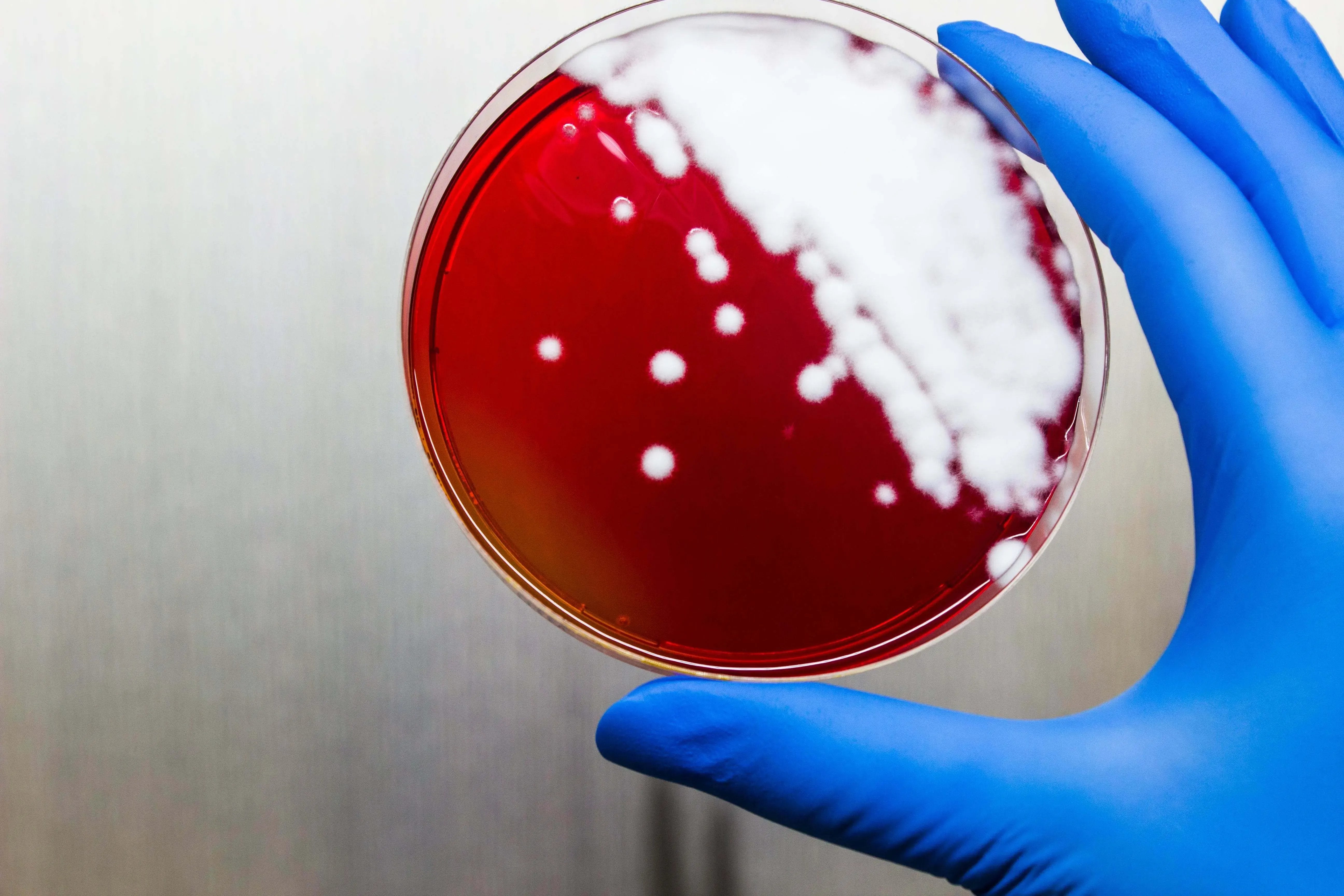 Liofilchem DERMATOPHYTE (D.T.M.) Agar Culture Media 11052
