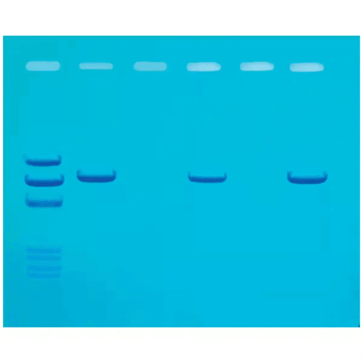 EDVOTEK Biotech Education UNIT Detection of Mad Cow Disease