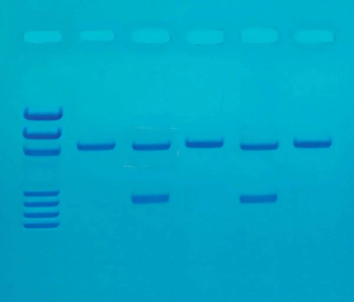 EDVOTEK Biotech Education UNIT Detection of the Influenza Virus