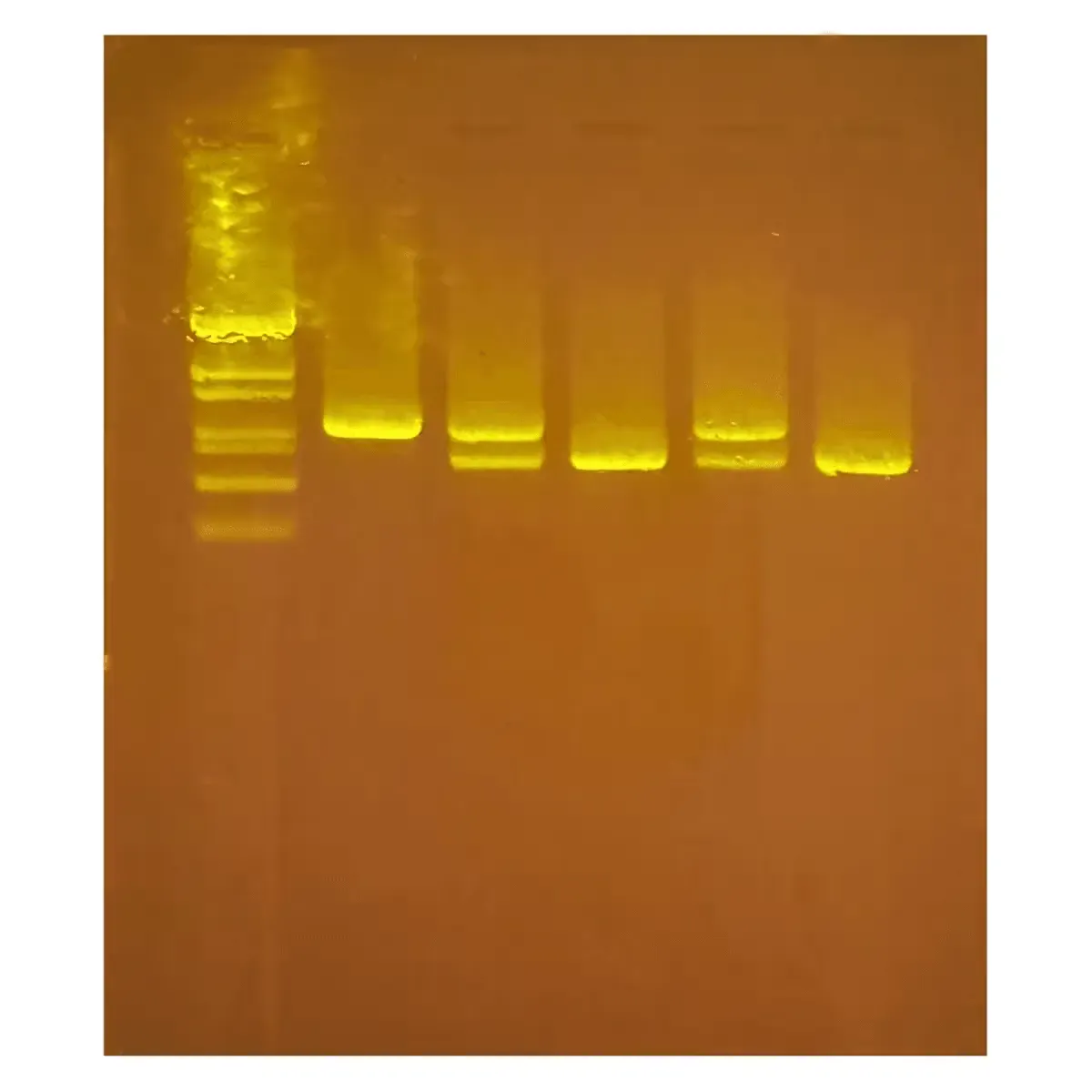 EDVOTEK Biotech Education UNIT Diagnosing Huntington's Using PCR
