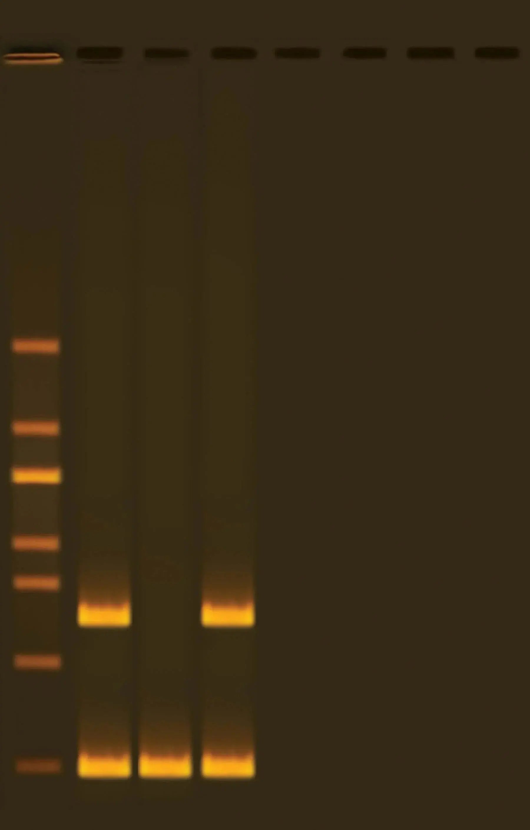 EDVOTEK Biotech Education UNIT GFP Transformation Extension: Colony PCR