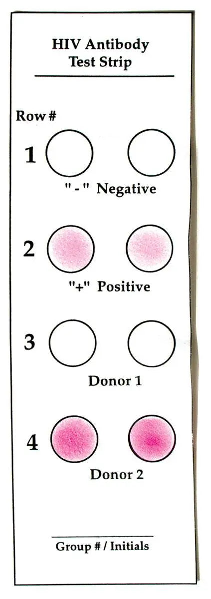 EDVOTEK Biotech Education UNIT How Does a Doctor Test for AIDS?