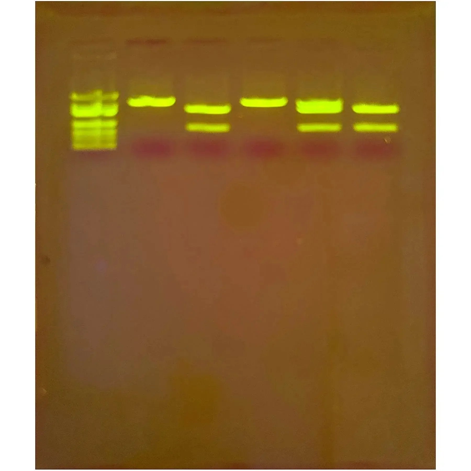 EDVOTEK Biotech Education UNIT In Search of the Cholesterol Gene