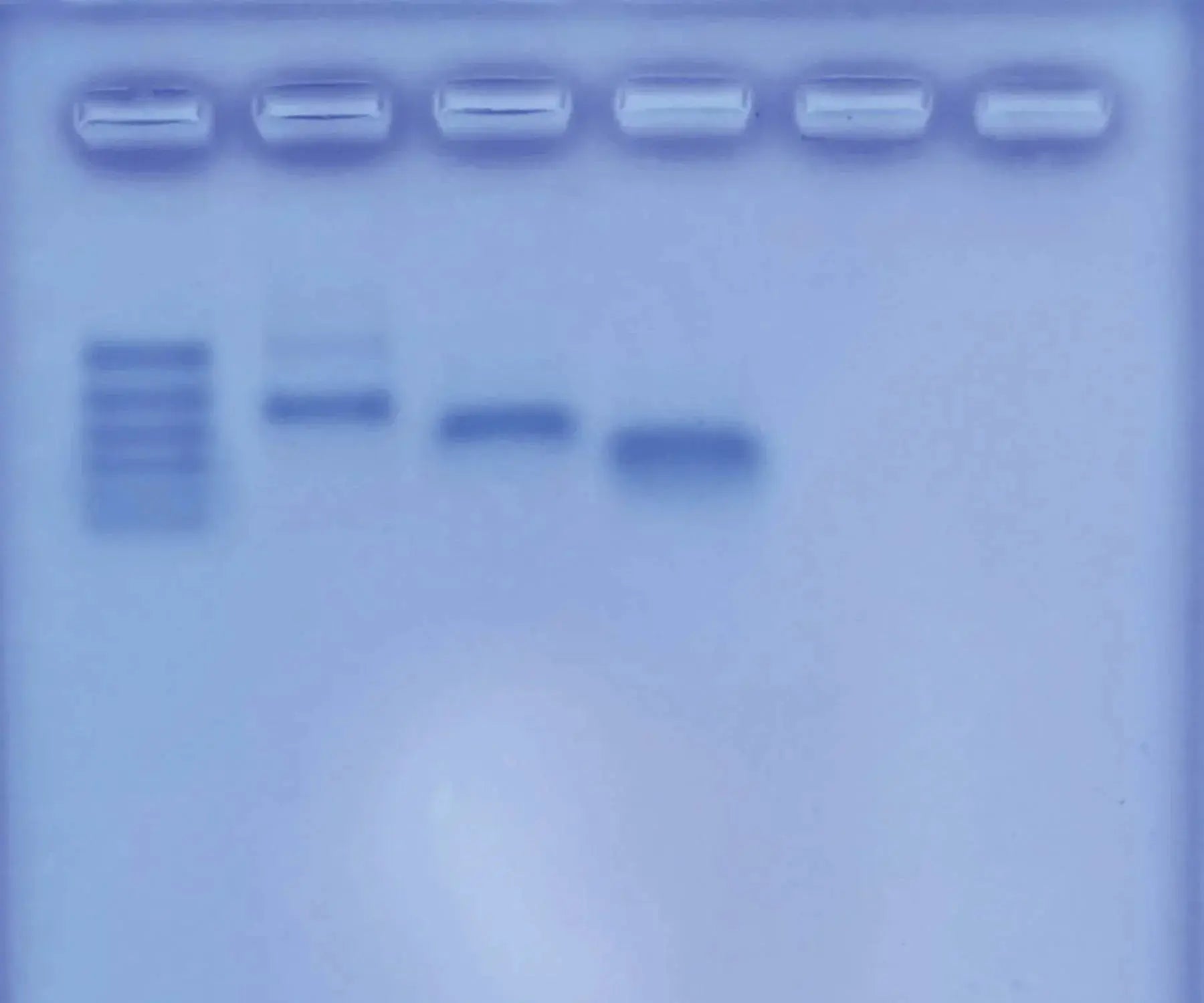 EDVOTEK Biotech Education UNIT Molecular Weight Determination of Proteins