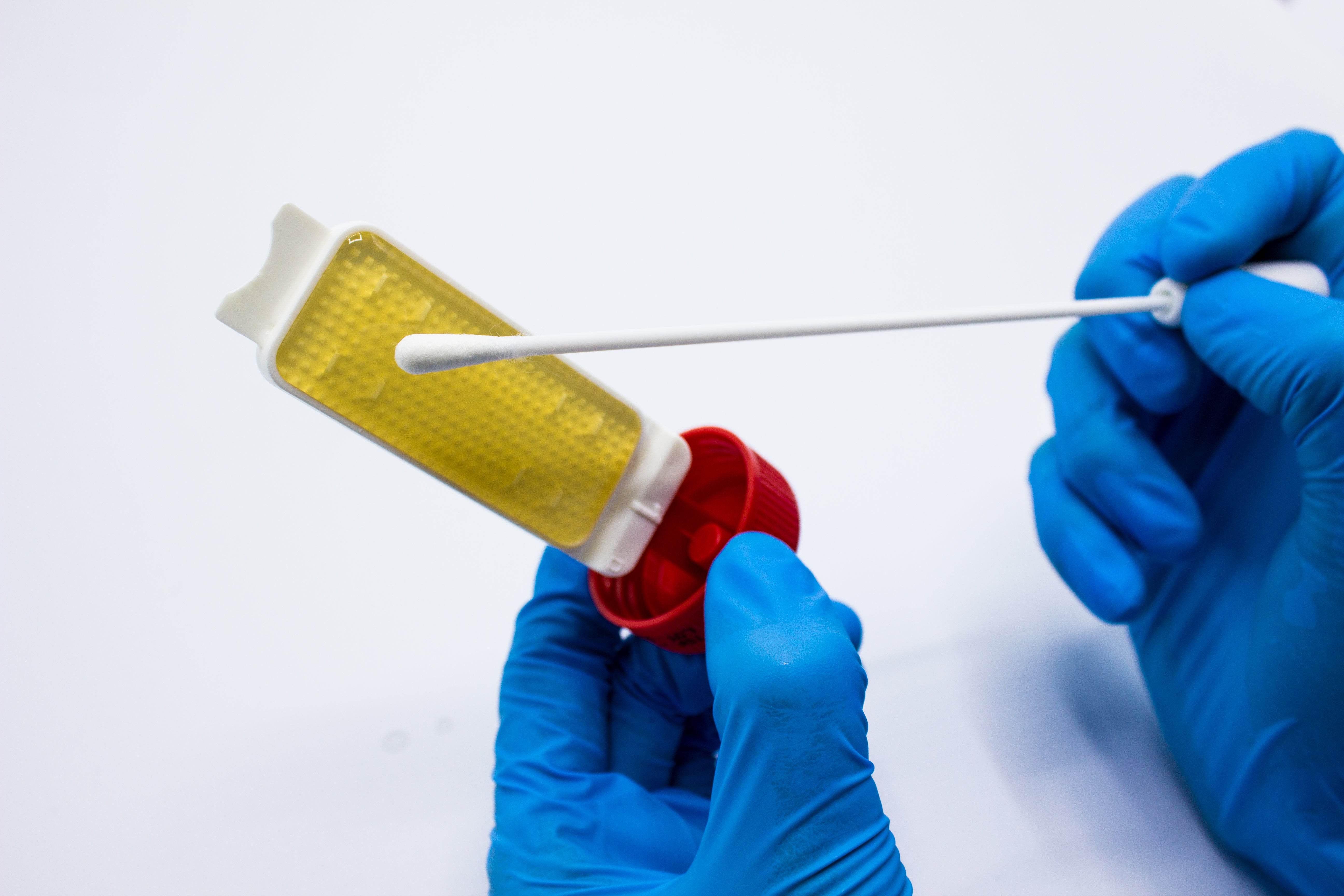 Uritest - For Microbiology Lab Testing