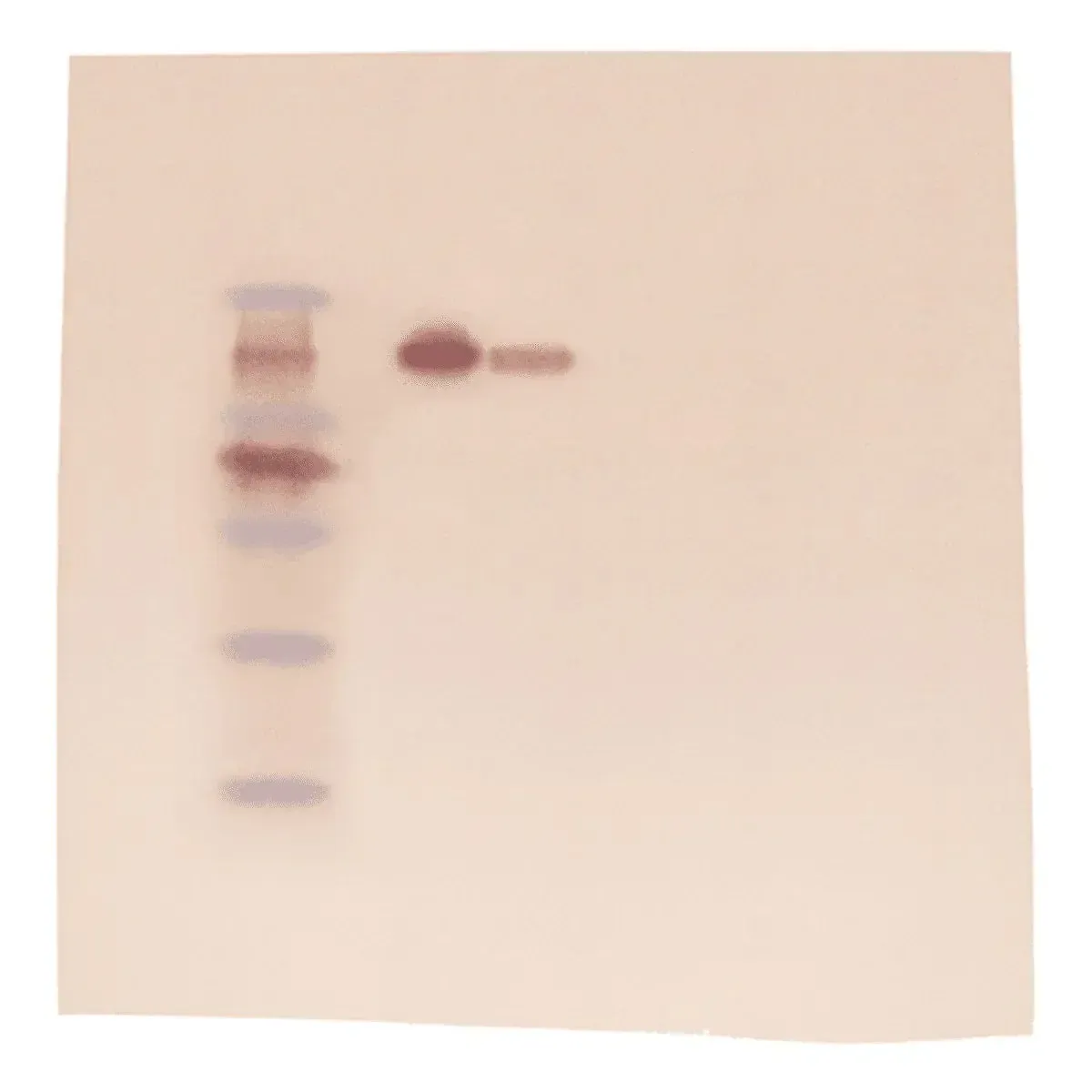 EDVOTEK Biotech Education UNIT Western Blot Analysis (Polyacrylamide-based)